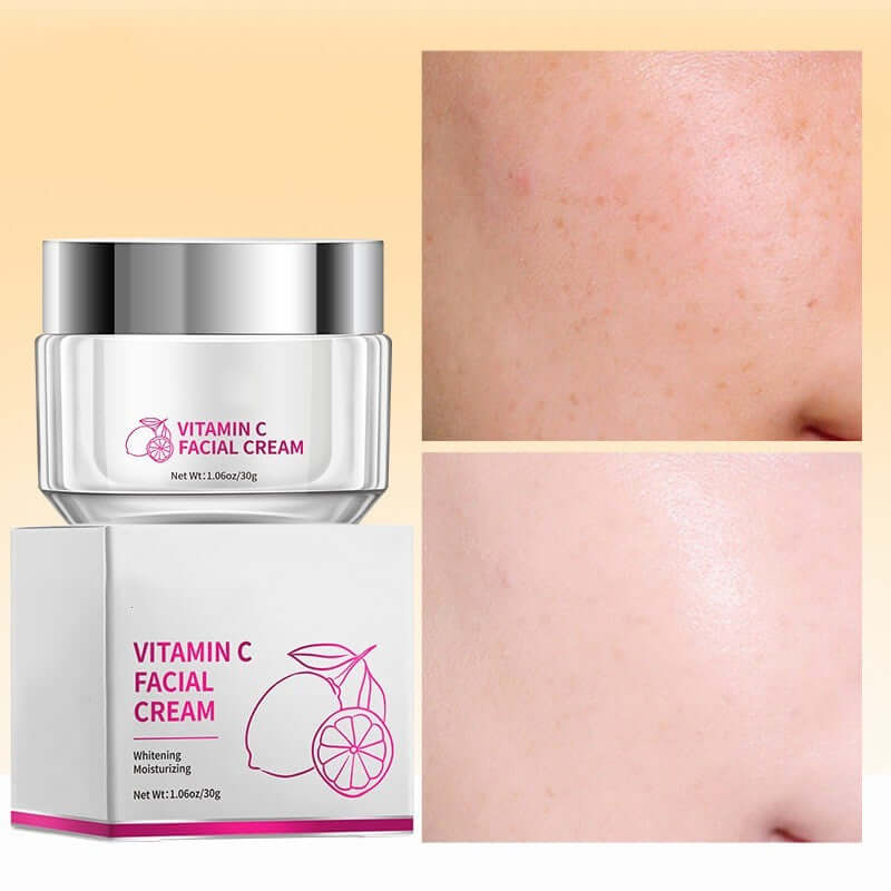 Vitamin C Facial Cream jar with before and after images showing improved skin texture and tone.